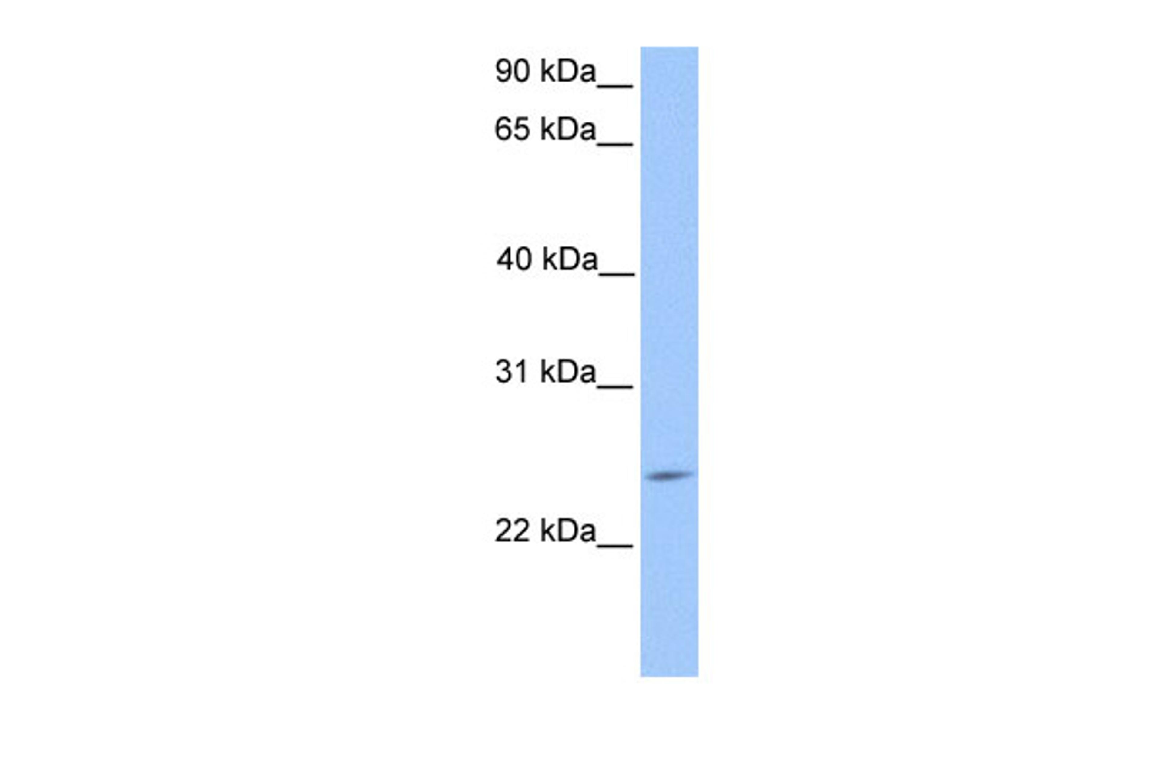 Antibody used in WB on Human HepG2 at 0.2-1 ug/ml.