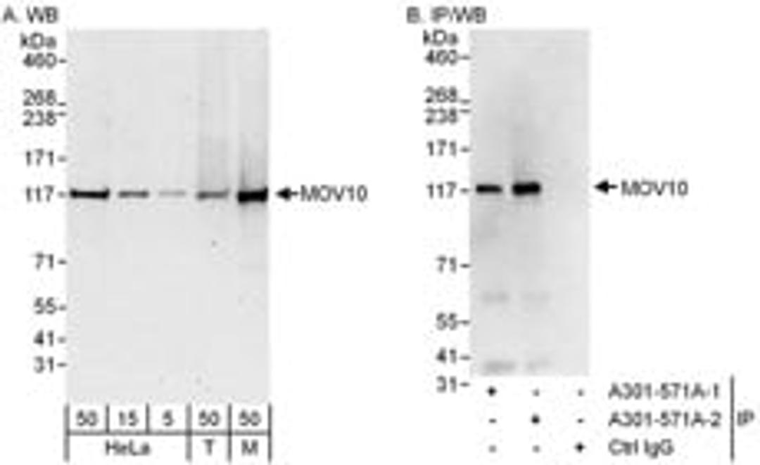 Detection of human and mouse MOV10 by western blot (h&m) and immunoprecipitation (h).