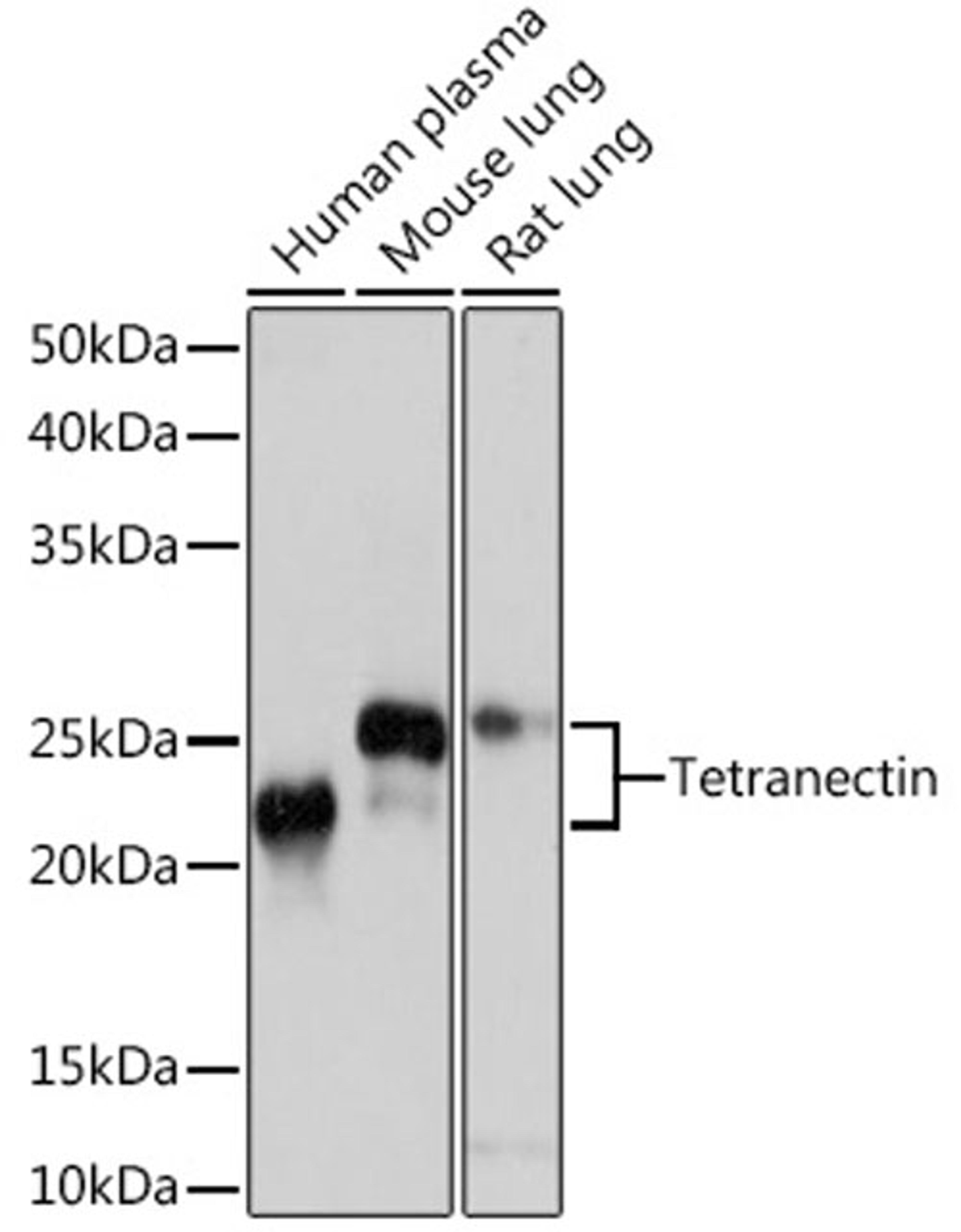 Western blot - Tetranectin Rabbit mAb (A4387)