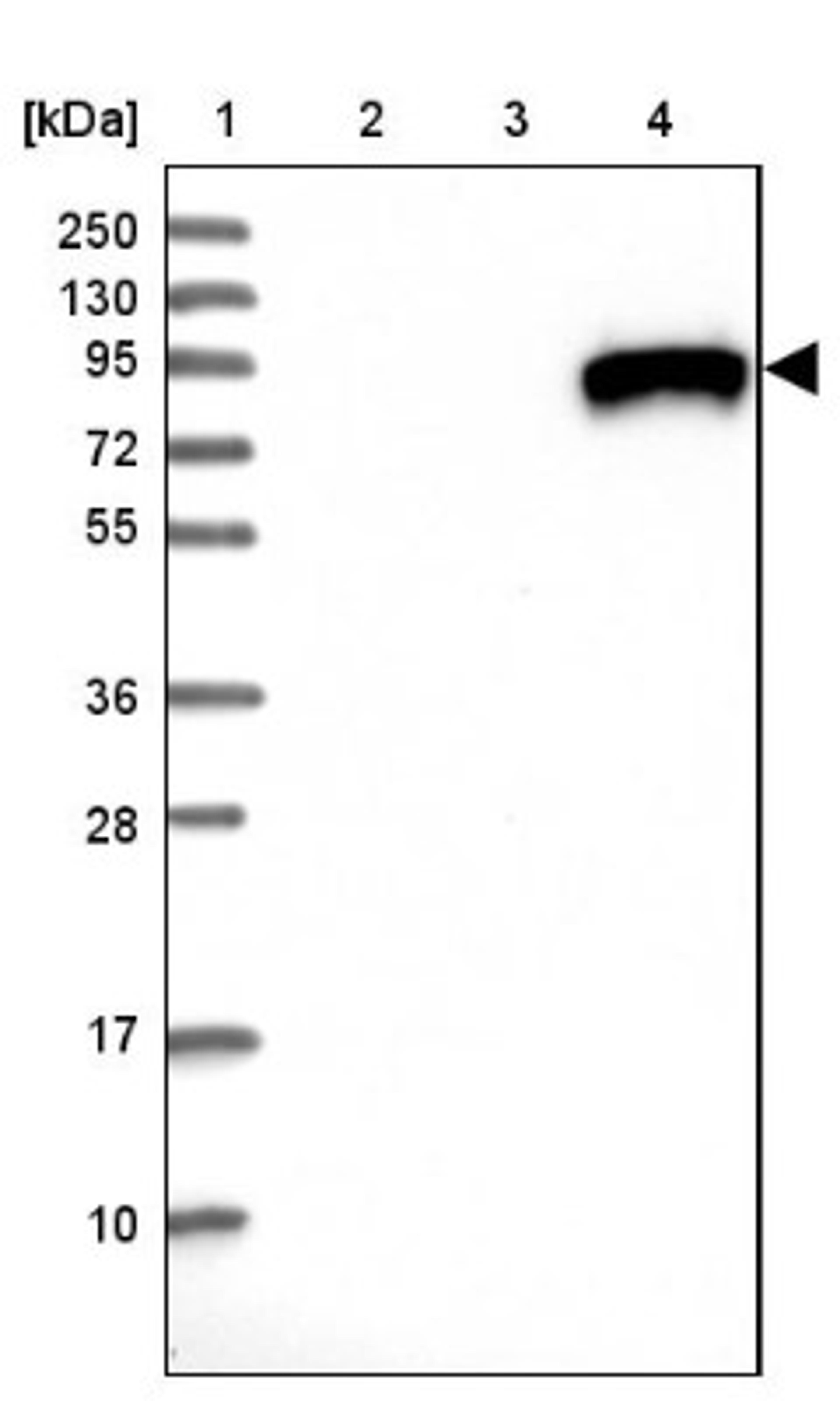 Western Blot: IGFALS Antibody [NBP1-89118] - Lane 1: Marker [kDa] 250, 130, 95, 72, 55, 36, 28, 17, 10<br/>Lane 2: Human cell line RT-4<br/>Lane 3: Human cell line U-251MG sp<br/>Lane 4: Human plasma (IgG/HSA depleted)