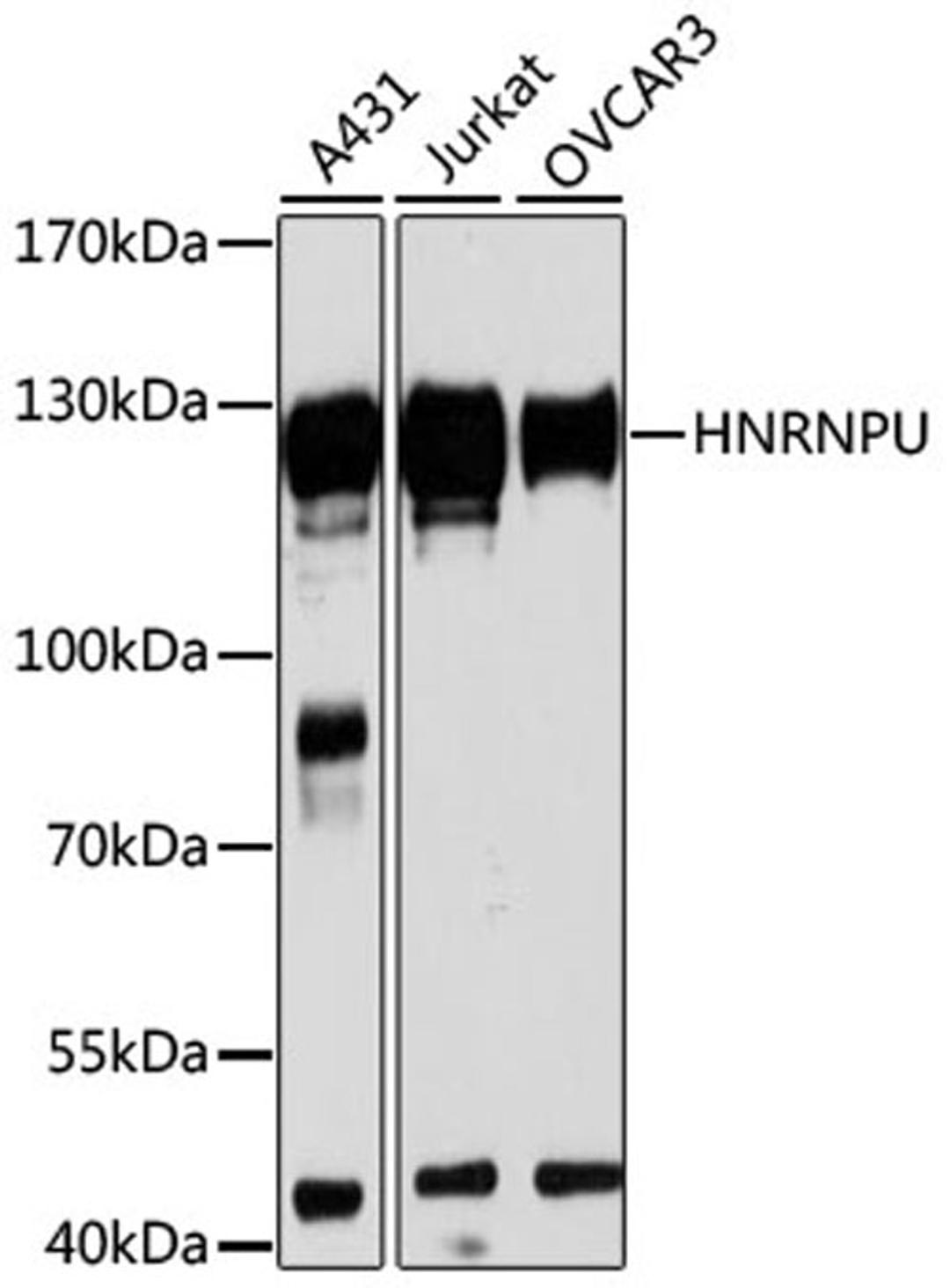 Western blot - HNRNPU antibody (A3917)