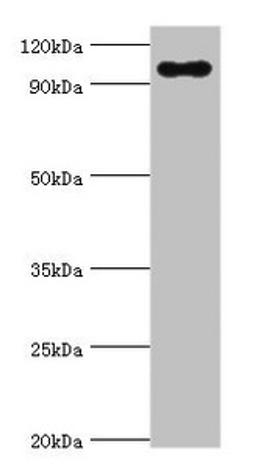 Western blot. All lanes: TGS1 antibody at 10ug/ml + Mouse skeletal muscle tissue. Secondary. Goat polyclonal to rabbit IgG at 1/10000 dilution. Predicted band size: 97 kDa. Observed band size: 97 kDa. 