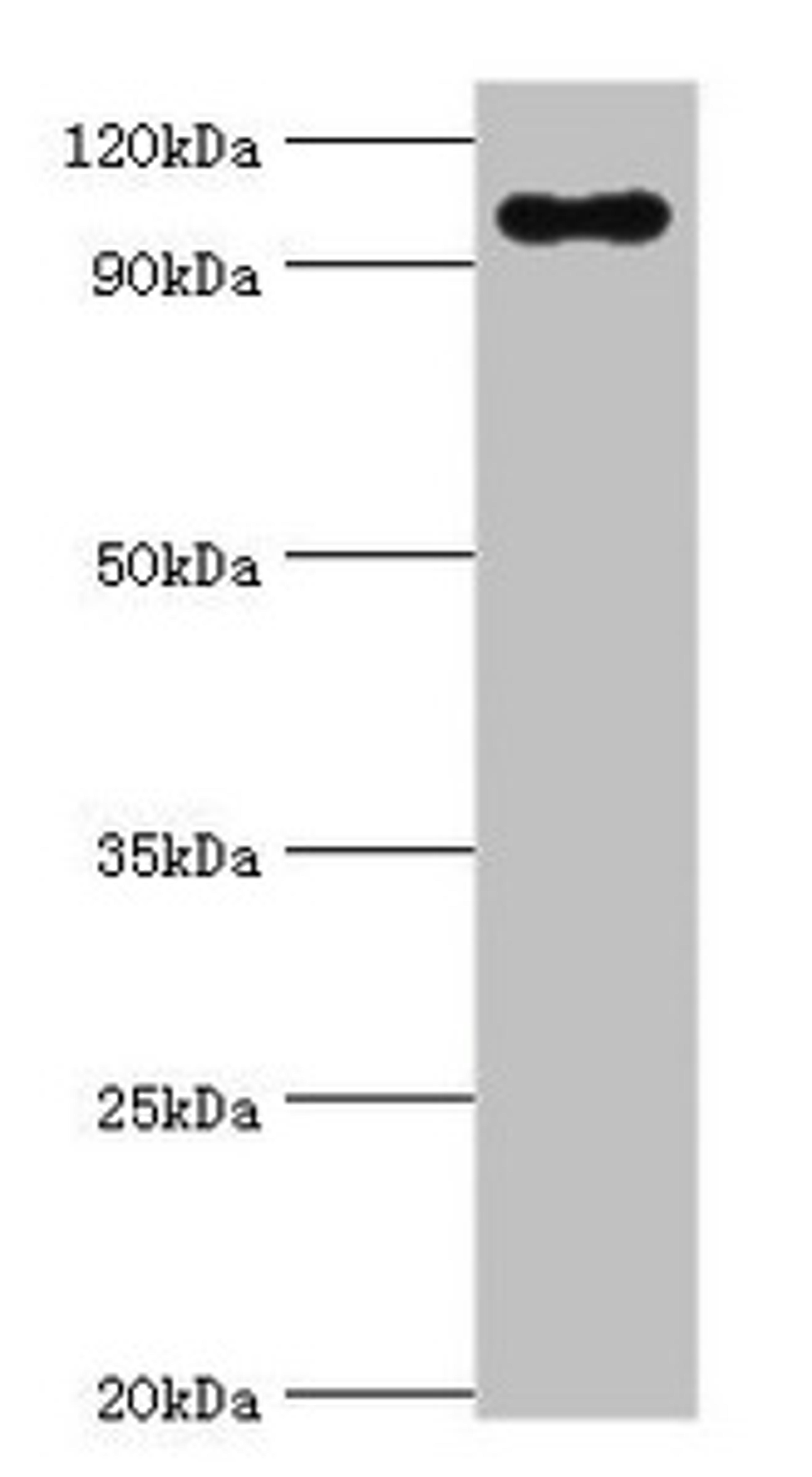 Western blot. All lanes: TGS1 antibody at 10ug/ml + Mouse skeletal muscle tissue. Secondary. Goat polyclonal to rabbit IgG at 1/10000 dilution. Predicted band size: 97 kDa. Observed band size: 97 kDa. 