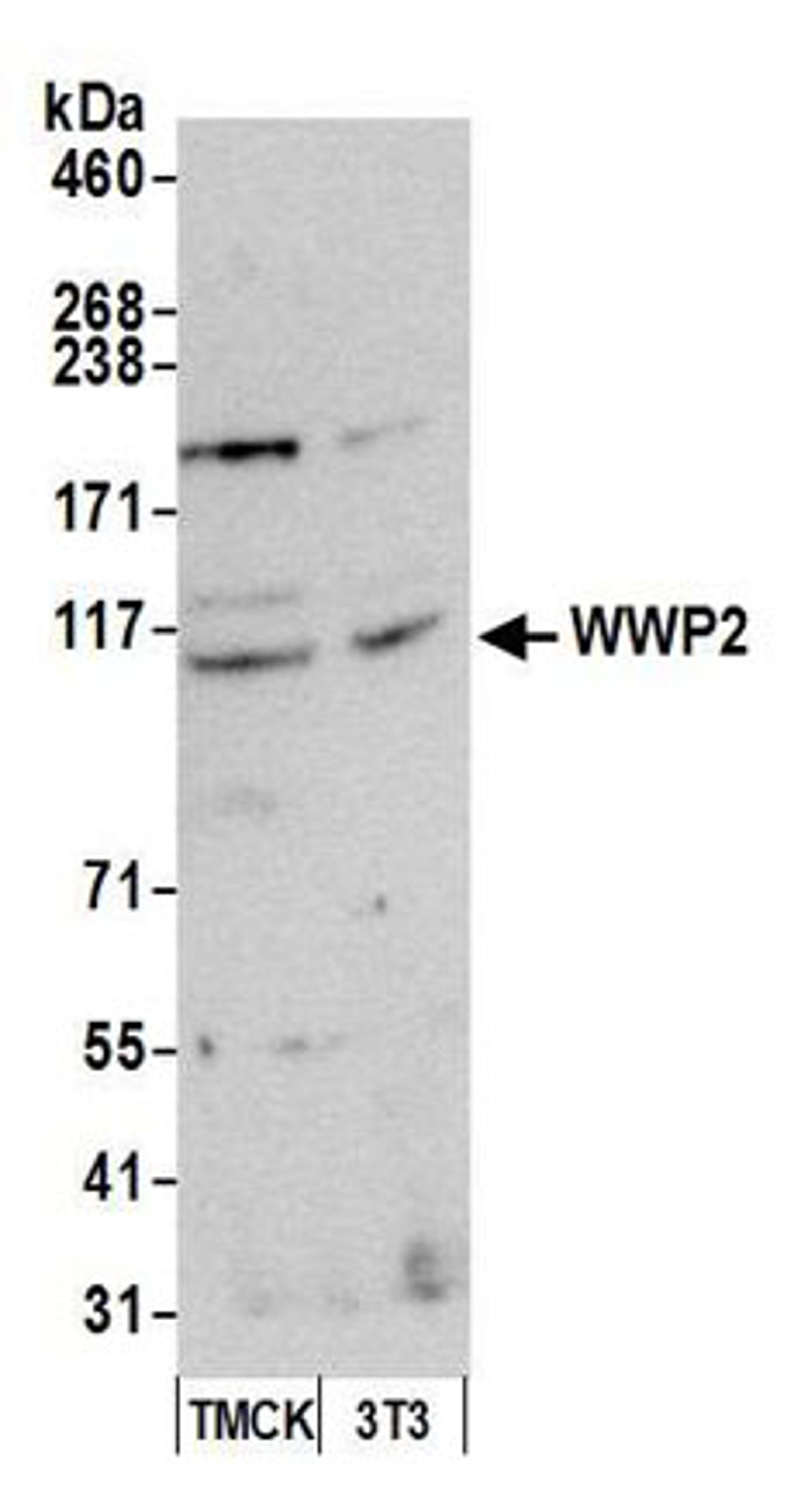 Detection of mouse WWP2 by western blot.