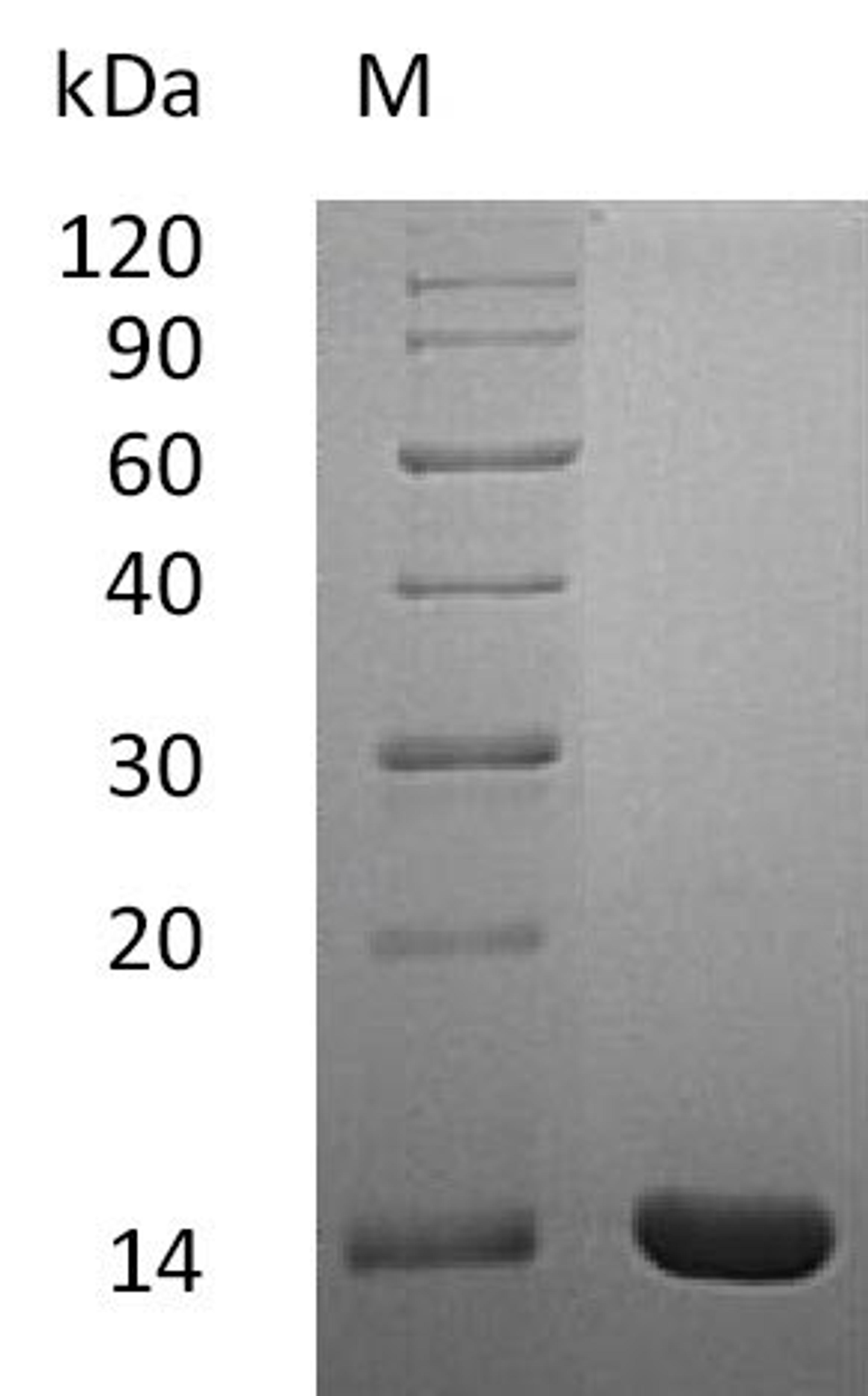 (Tris-Glycine gel) Discontinuous SDS-PAGE (reduced) with 5% enrichment gel and 15% separation gel.