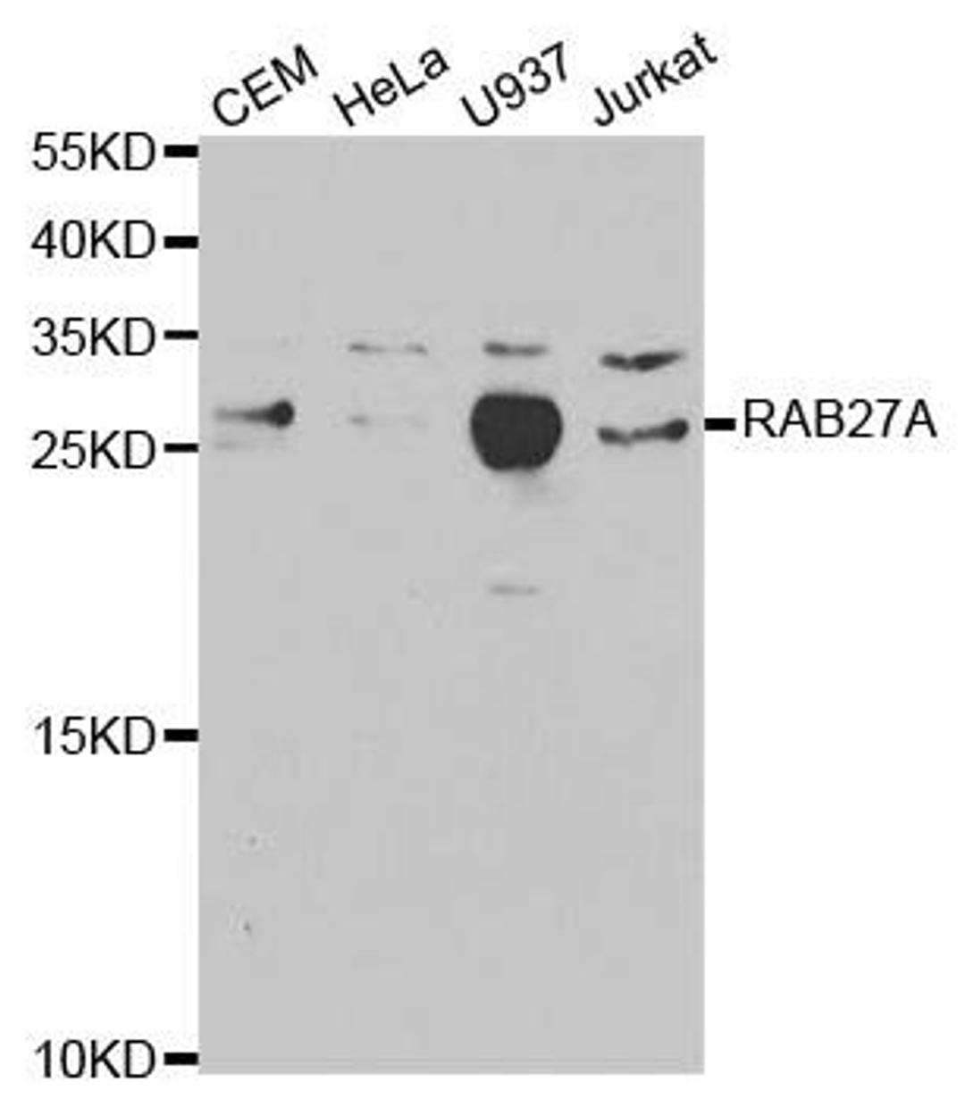 Western blot analysis of extracts of various cell lines using RAB27A antibody