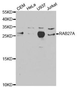 Western blot analysis of extracts of various cell lines using RAB27A antibody