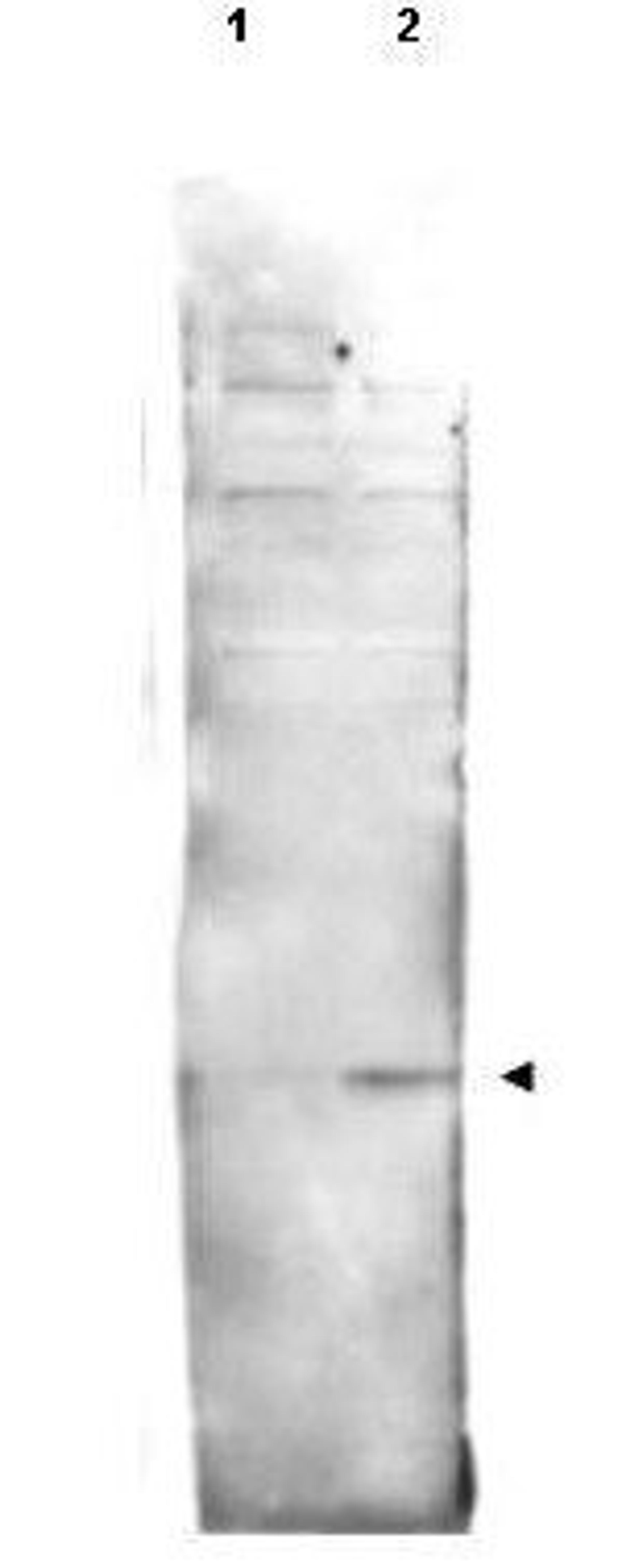 Western blot analysis of (lane 2 arrow-head). Lanes contain either mock-irradiated (lane 1) or 4000-RAD gamma irradiated (lane 2) Drosophila melanogaster (3rd instar) larvae brain using Histone H2AvD pS137 antibody