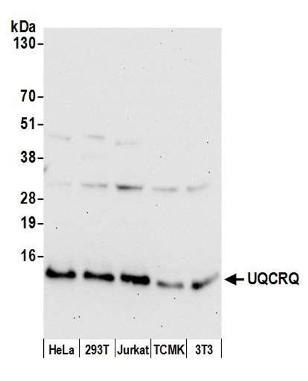 Detection of human and mouse UQCRQ by WB.