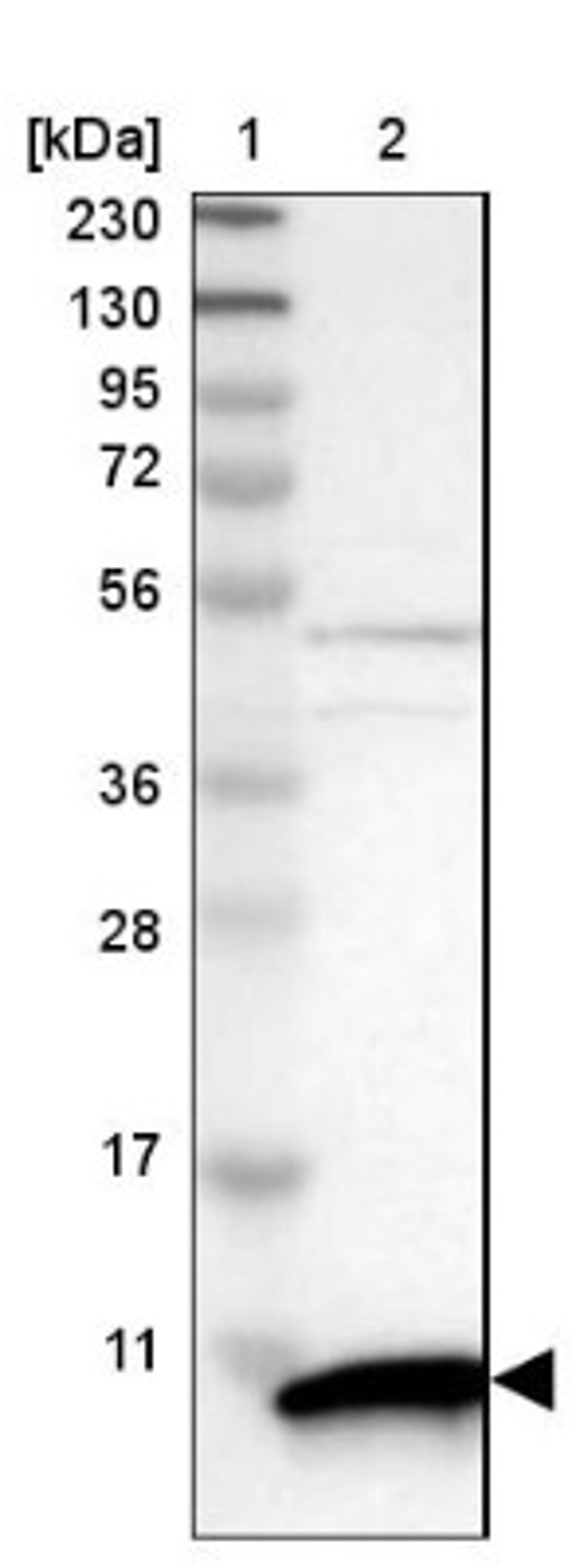 Western Blot: S100P Antibody [NBP1-89541] - Lane 1: Marker [kDa] 230, 130, 95, 72, 56, 36, 28, 17, 11<br/>Lane 2: Human cell line RT-4