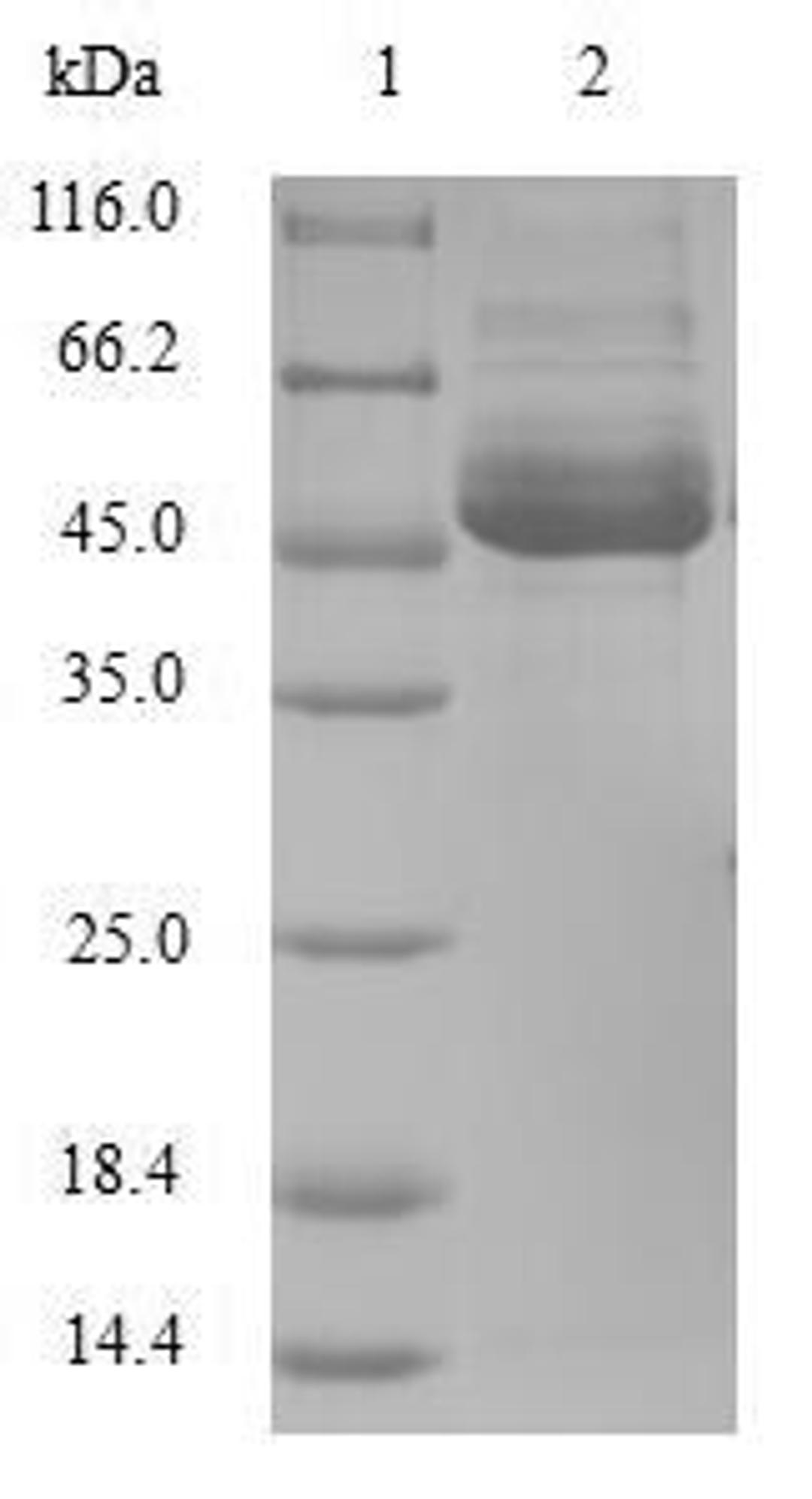 (Tris-Glycine gel) Discontinuous SDS-PAGE (reduced) with 5% enrichment gel and 15% separation gel.