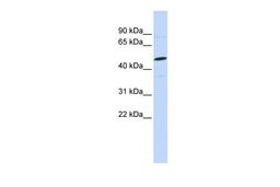 Antibody used in WB on Human MCF-7 at 0.2-1 ug/ml.