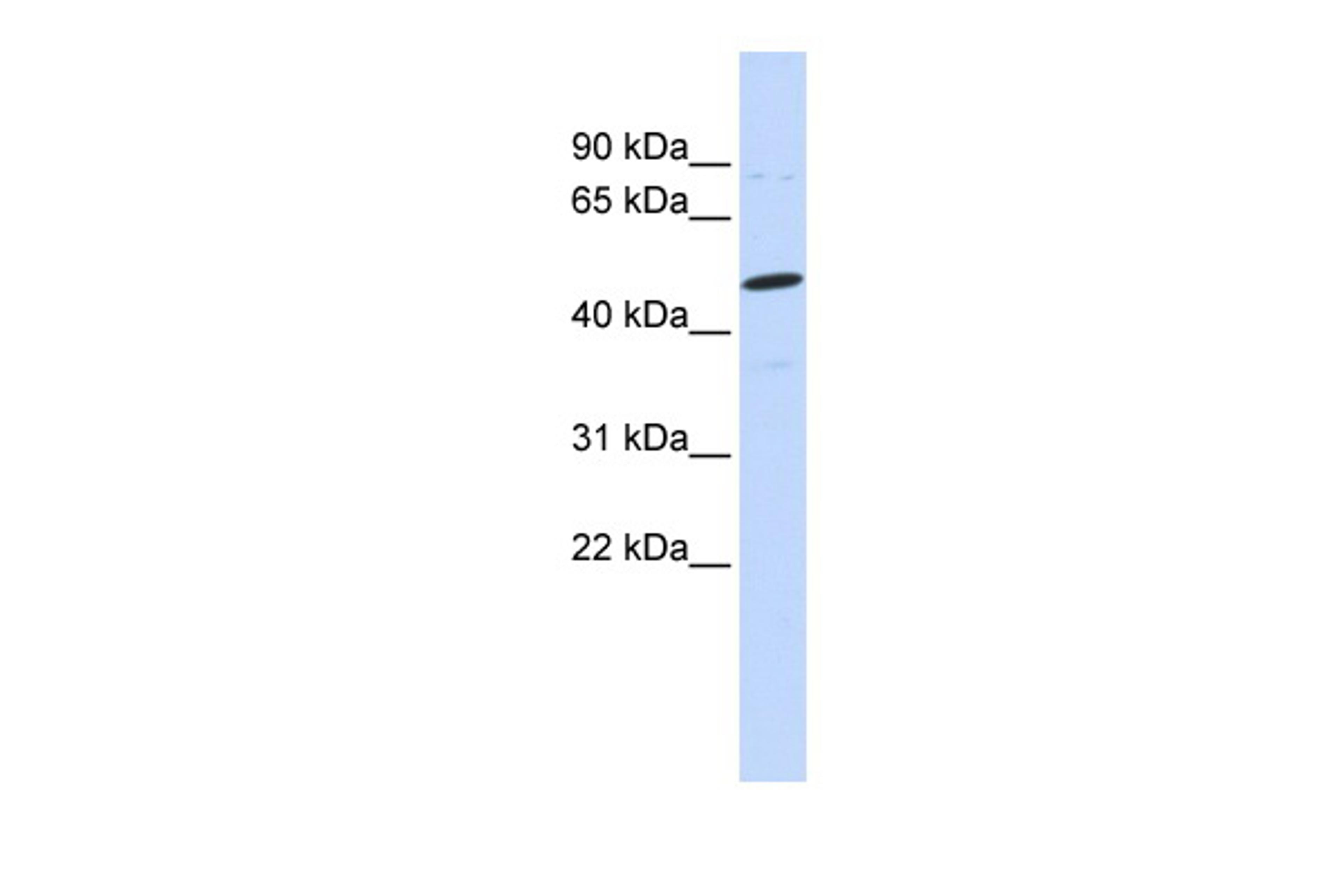 Antibody used in WB on Human MCF-7 at 0.2-1 ug/ml.