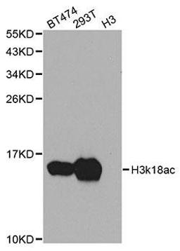 Western blot analysis of extracts of various cell lines using Acetyl-Histone H3-K18 antibody