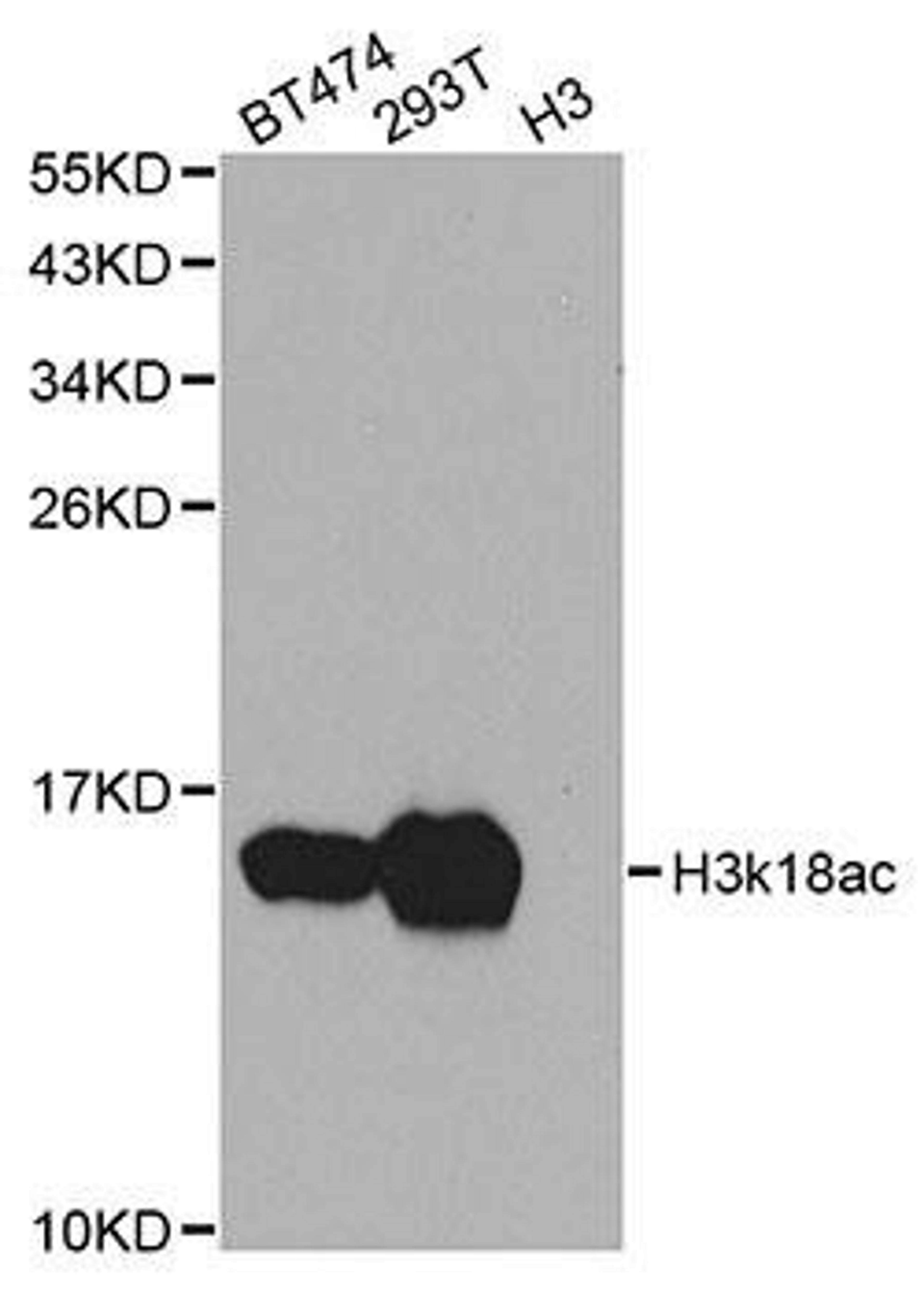 Western blot analysis of extracts of various cell lines using Acetyl-Histone H3-K18 antibody