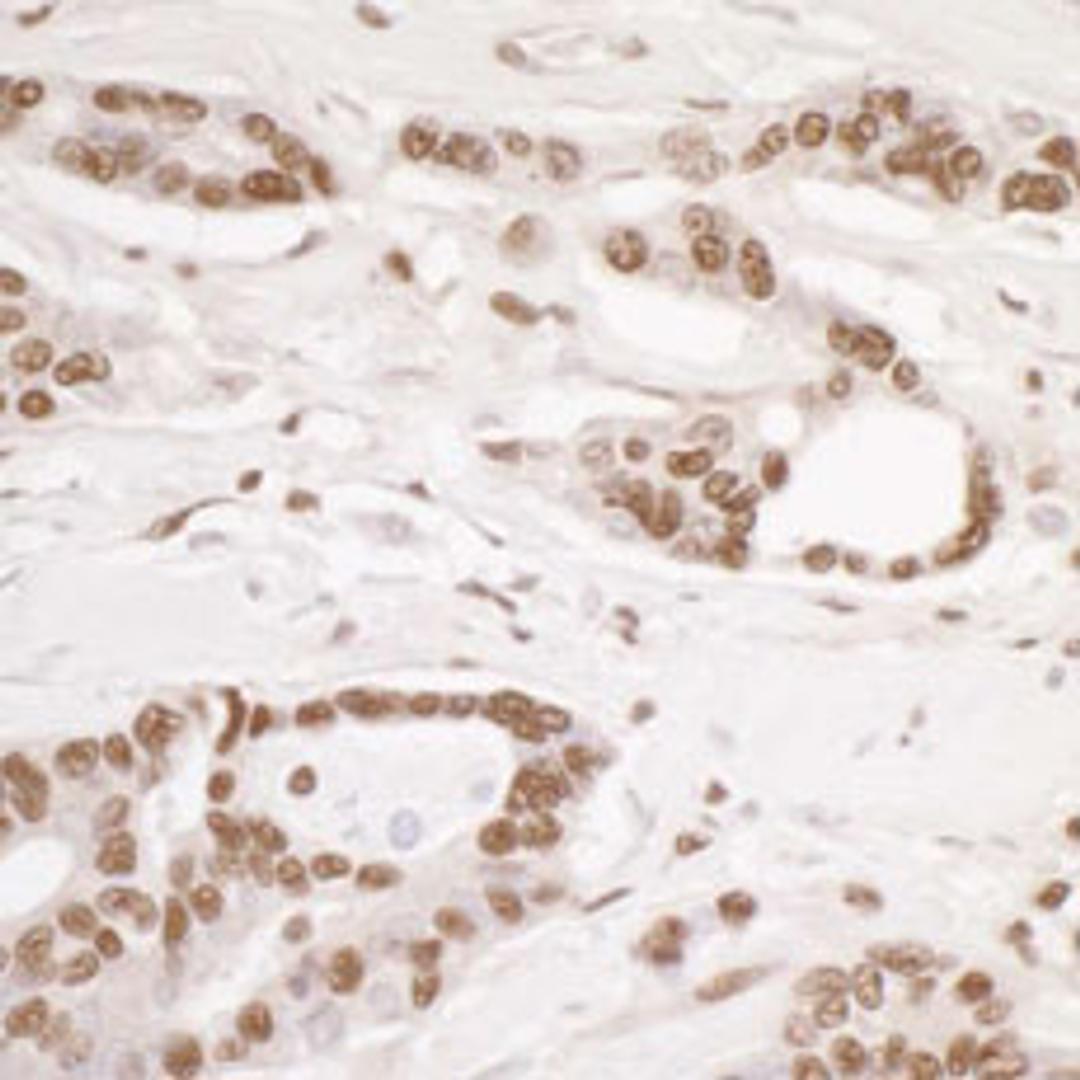 Detection of human DDB1 by immunohistochemistry.