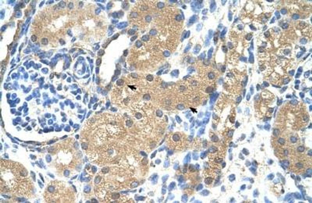 Immunohistochemistry-Paraffin: Troponin I Type 1 (slow skeletal) Antibody [NBP1-56641] - Human kidney Tissue, antibody concentration 4-8ug/ml. Cells with positive label: renal corpuscle cells (indicated with arrows) 400X magnification.