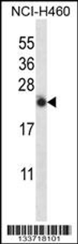 Western blot analysis in NCI-H460 cell line lysates (35ug/lane).