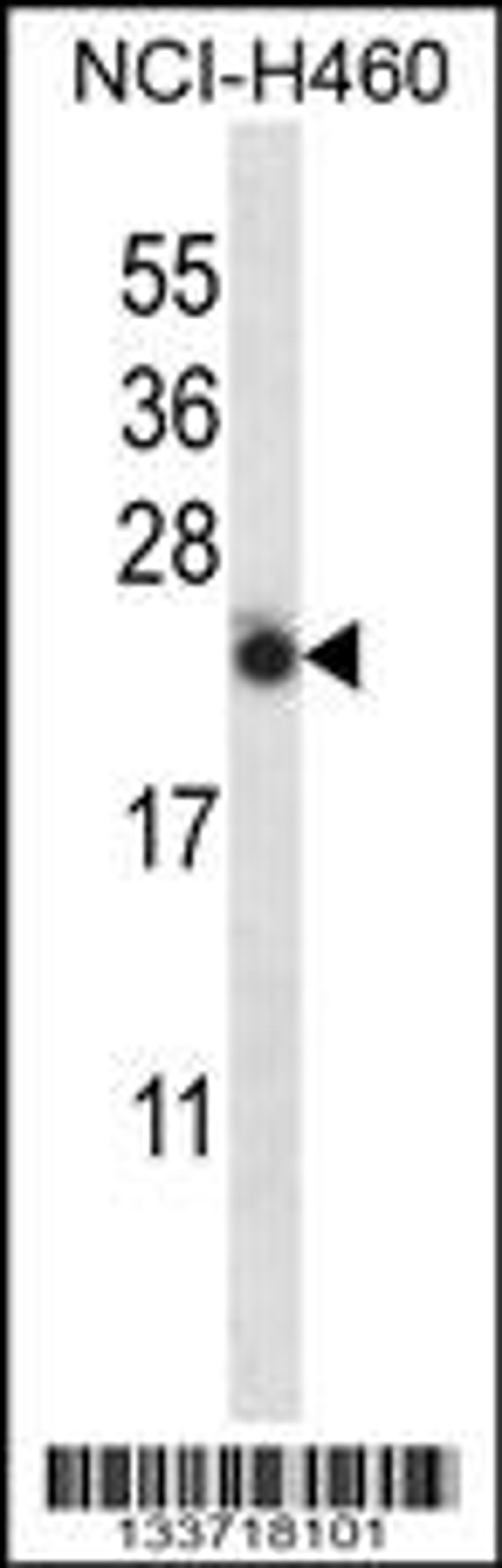 Western blot analysis in NCI-H460 cell line lysates (35ug/lane).