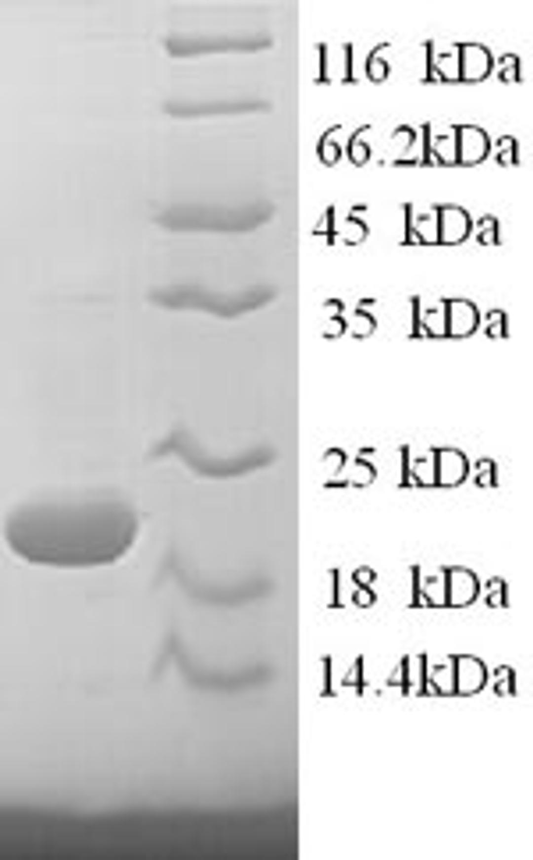 (Tris-Glycine gel) Discontinuous SDS-PAGE (reduced) with 5% enrichment gel and 15% separation gel.