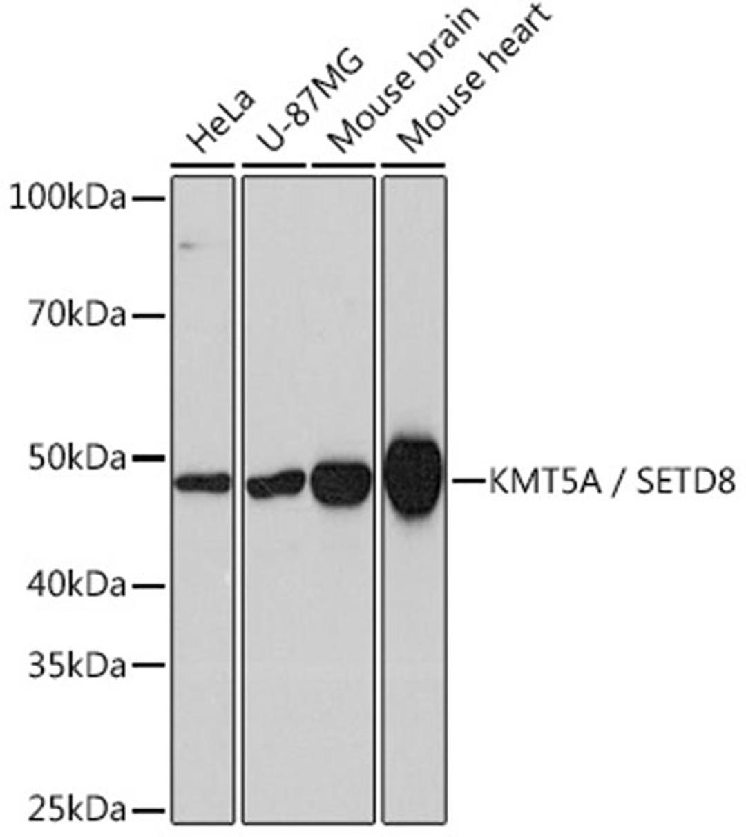 Western blot - KMT5A / SETD8 Rabbit mAb (A4136)