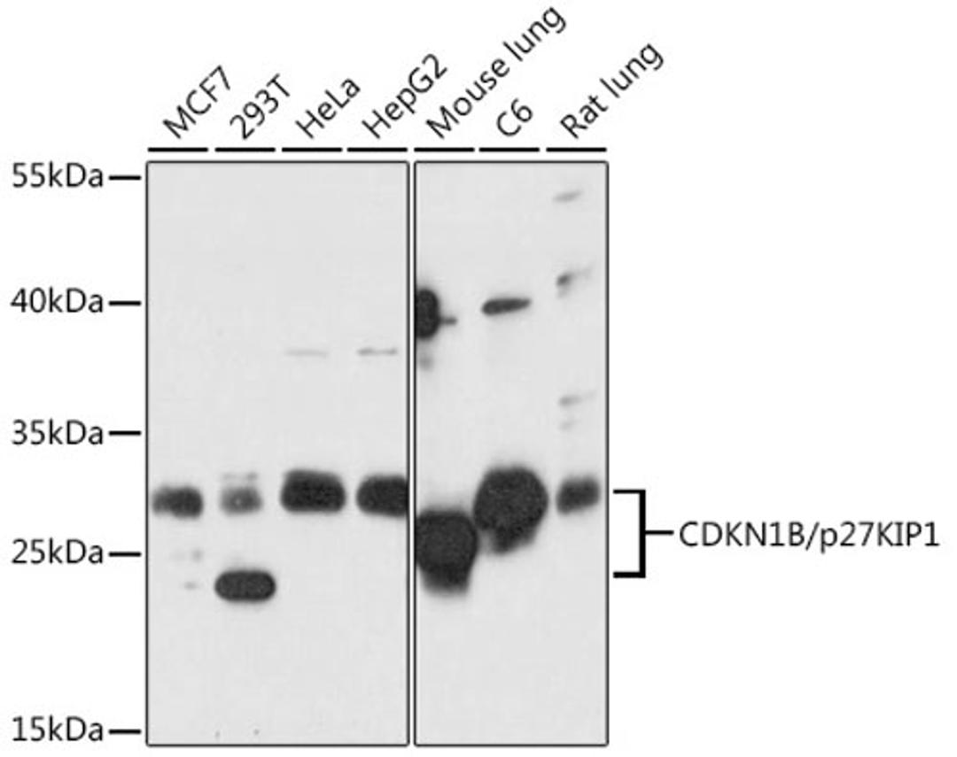 Western blot - CDKN1B/p27KIP1 antibody (A16722)