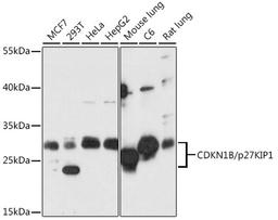 Western blot - CDKN1B/p27KIP1 antibody (A16722)