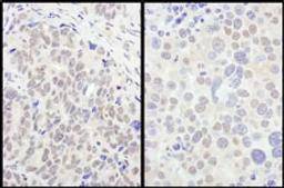 Detection of human and mouse FOXO3a by immunohistochemistry.