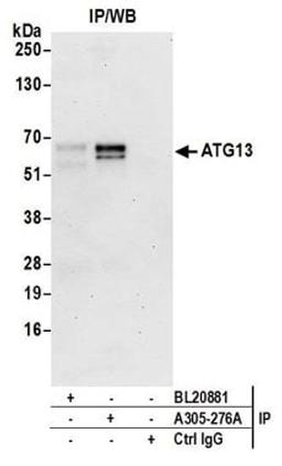 Detection of human ATG13 by western blot of immunoprecipitates.