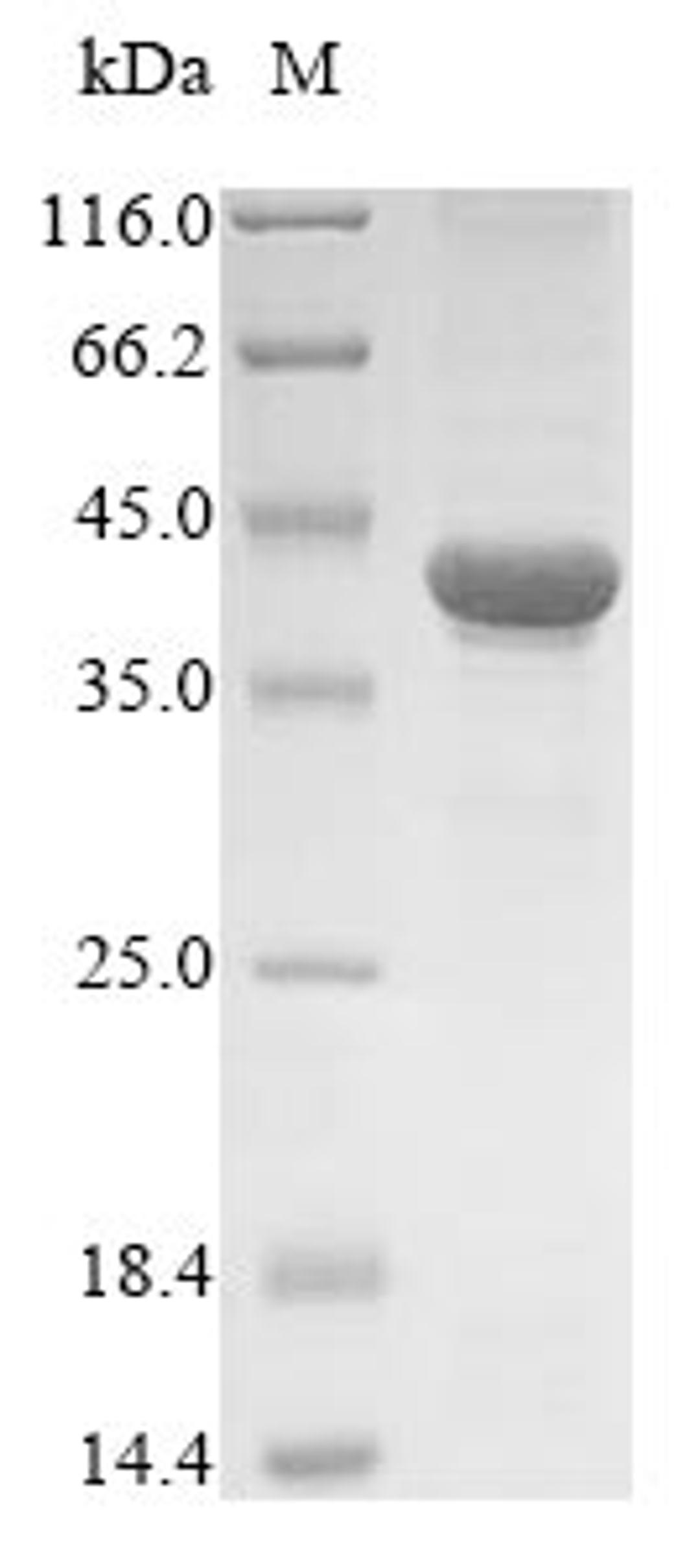 (Tris-Glycine gel) Discontinuous SDS-PAGE (reduced) with 5% enrichment gel and 15% separation gel.
