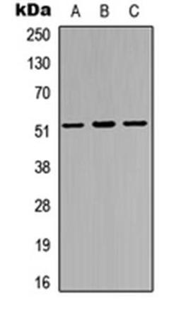 Western blot analysis of HEK293T (Lane1), PC12 (Lane2), HeLa (Lane3) whole cell using IRX3 antibody