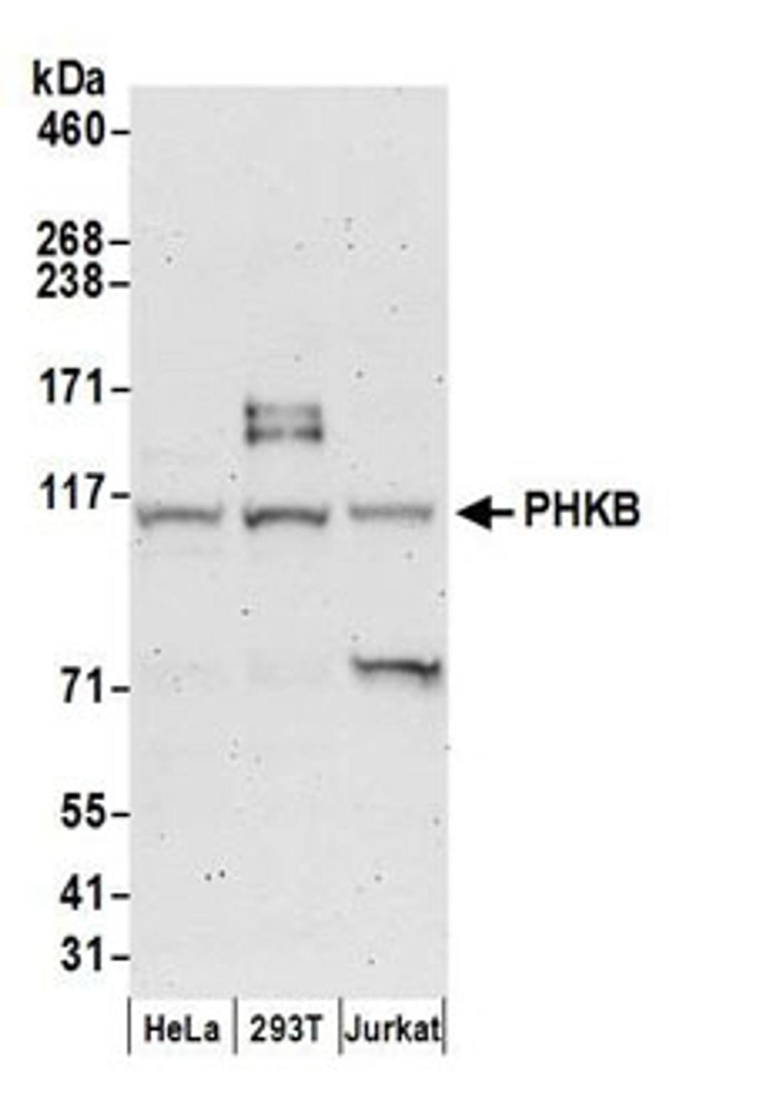 Detection of human PHKB by western blot.