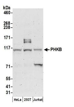 Detection of human PHKB by western blot.