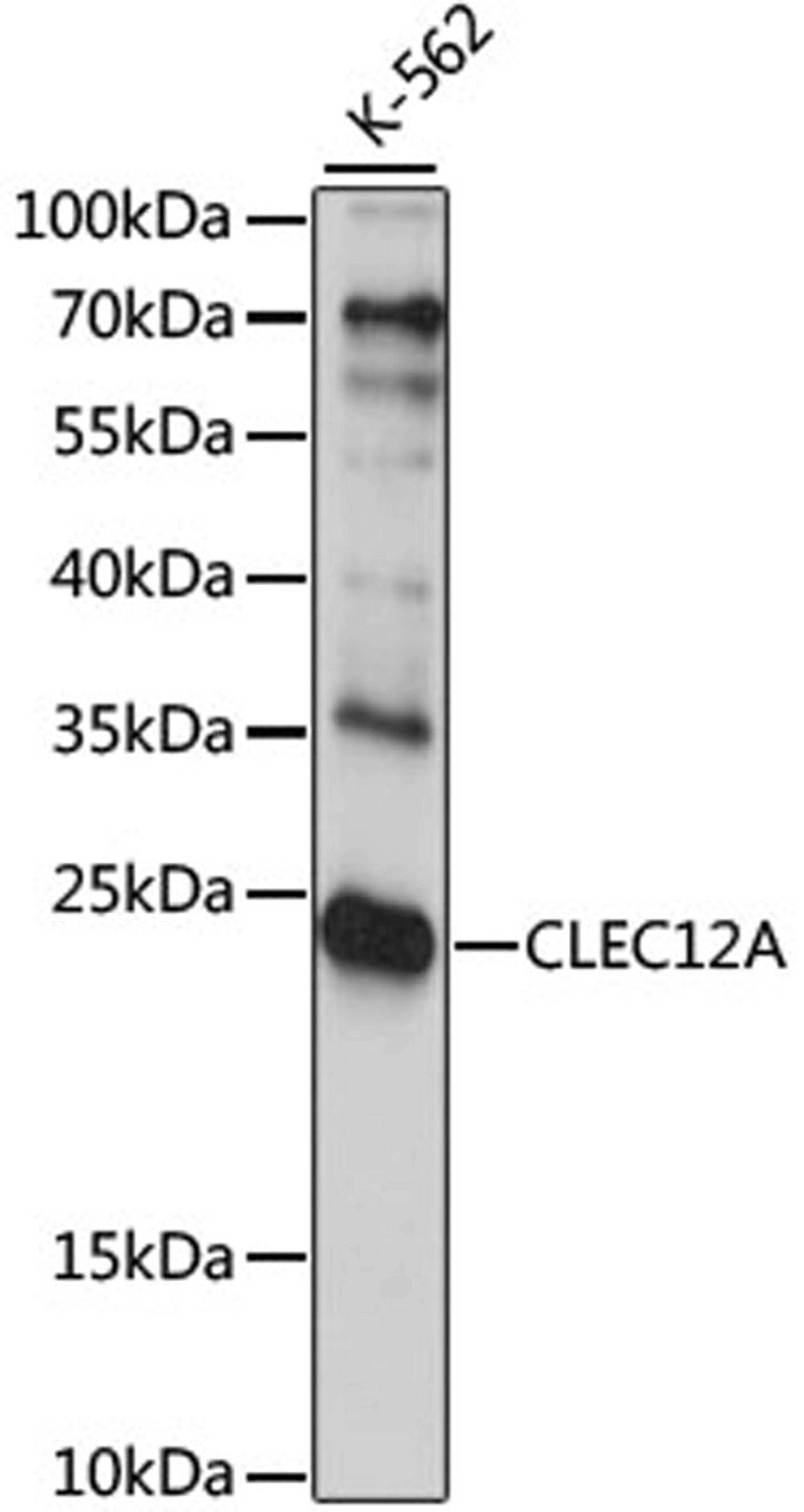 Western blot - CLEC12A antibody (A6250)