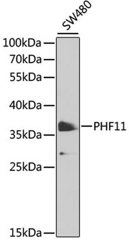 Western blot - PHF11 antibody (A13426)