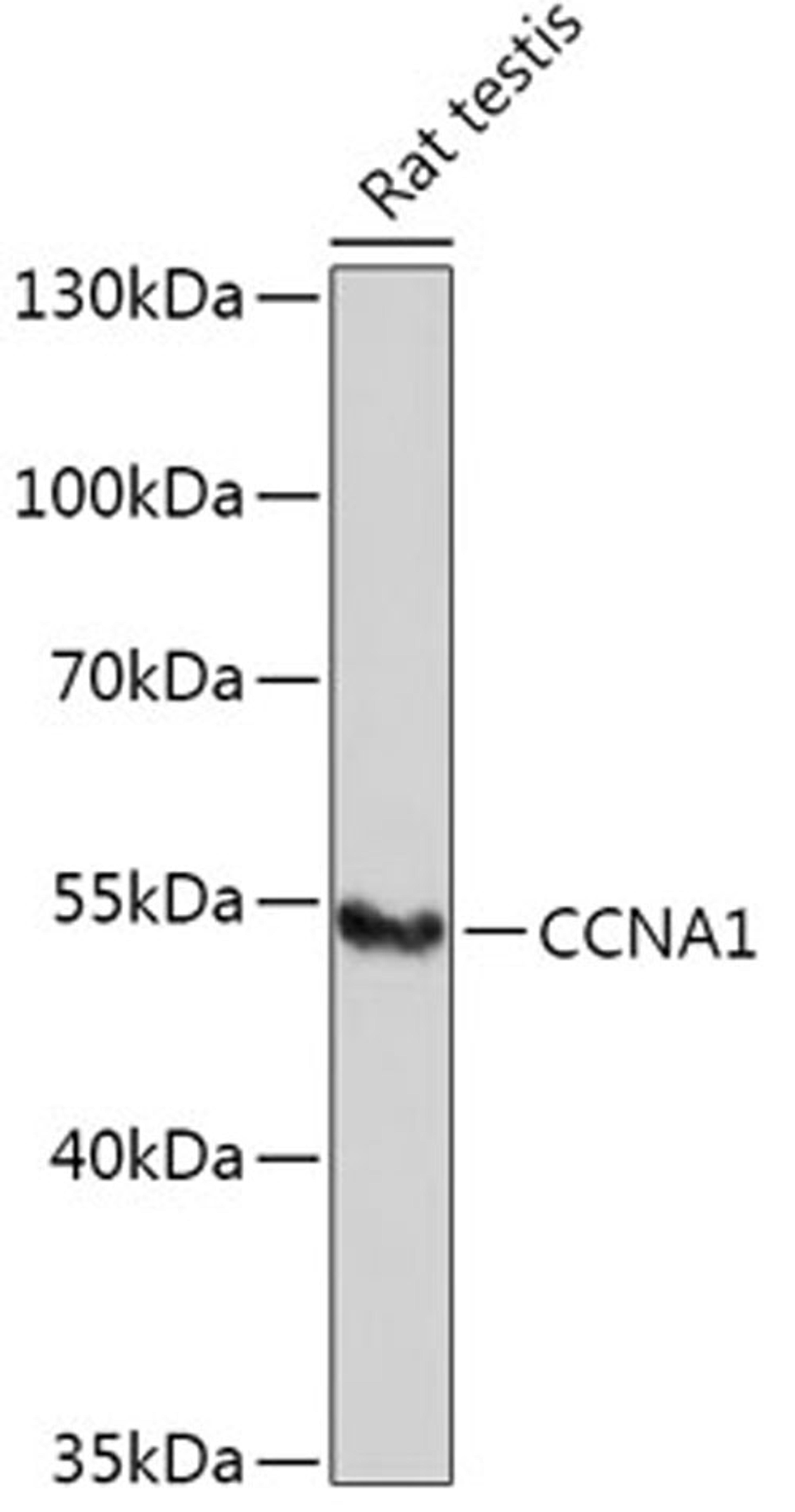 Western blot - CCNA1 antibody (A5631)