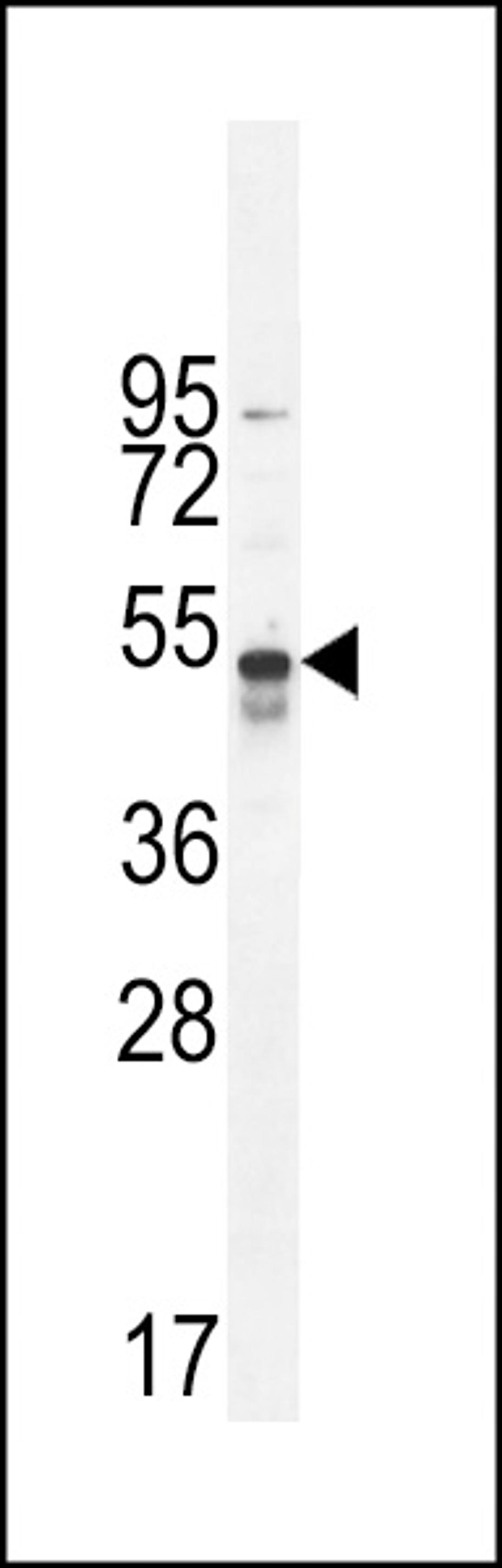 Western blot analysis in A549 cell line lysates (35ug/lane).This demonstrates the TNFR antibody detected the TNFR protein (arrow).