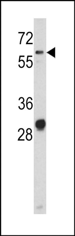 Western blot analysis of CD166 antibody in NCI-H460 cell line lysates (35ug/lane)