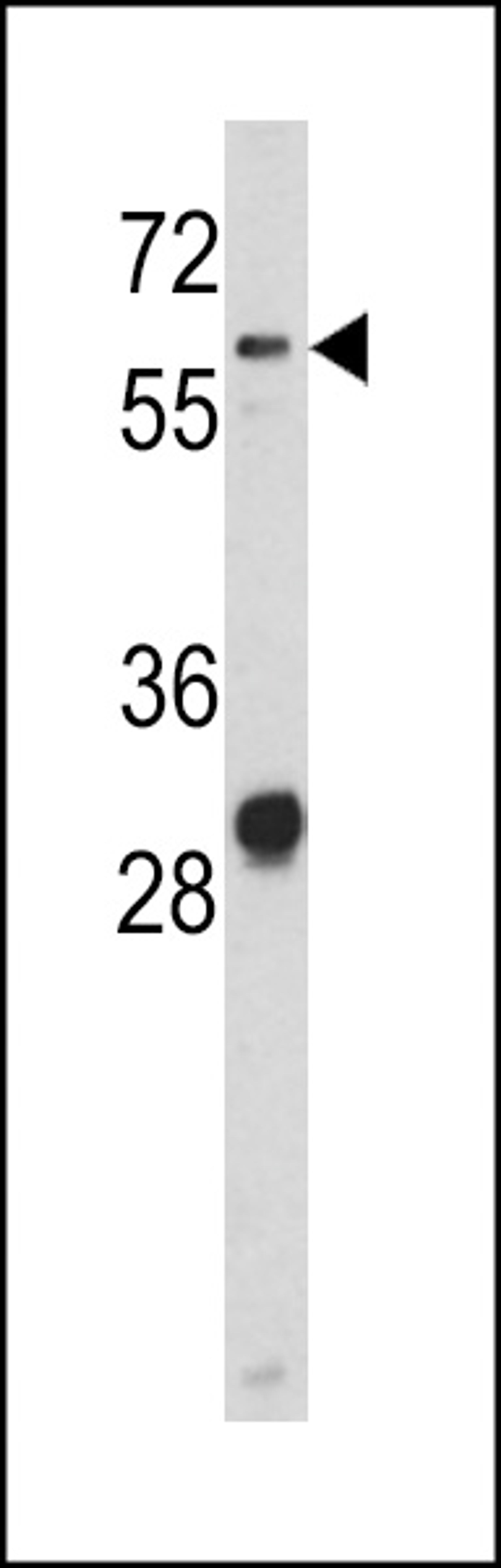 Western blot analysis of CD166 antibody in NCI-H460 cell line lysates (35ug/lane)