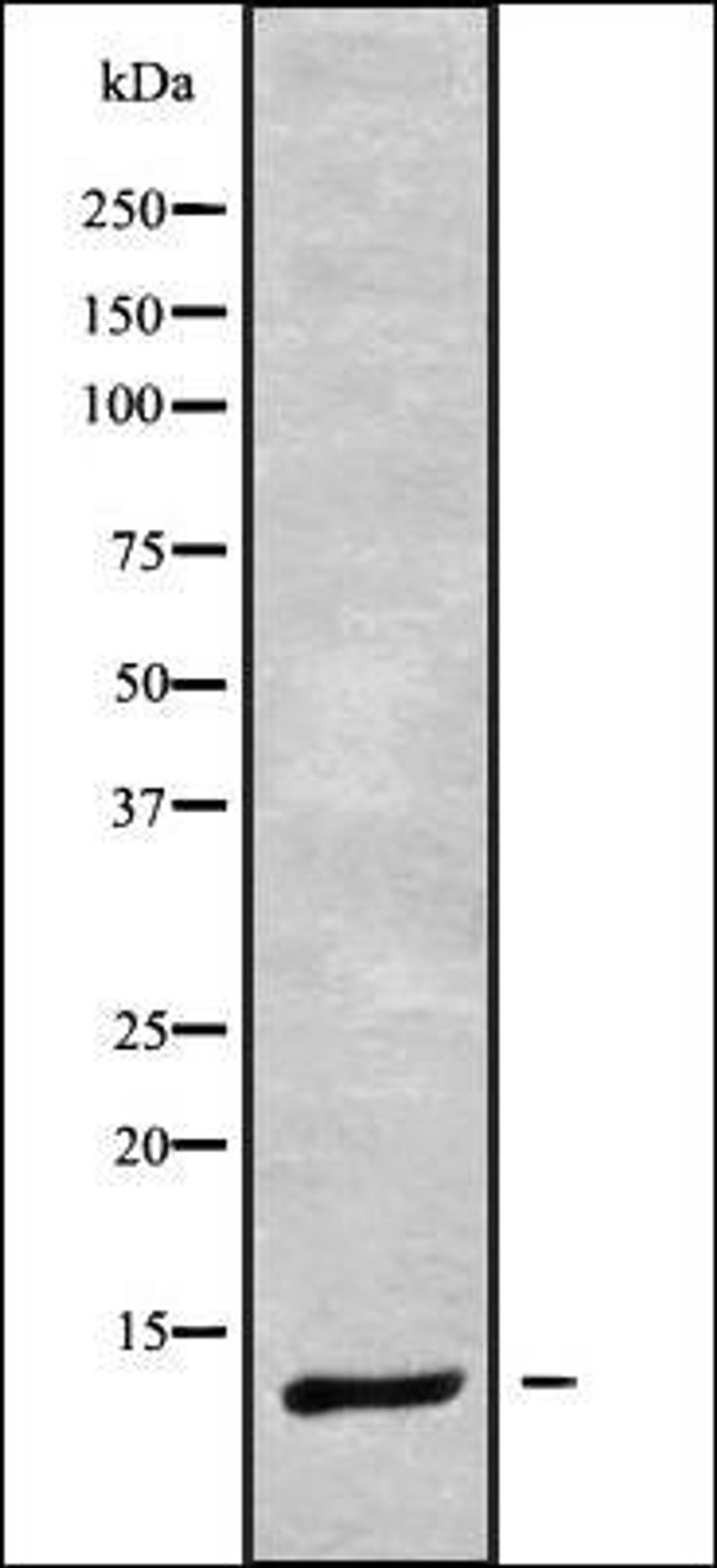 Western blot analysis of Jurkat whole cell lysates using DYNLRB1 antibody