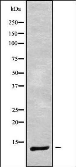 Western blot analysis of Jurkat whole cell lysates using DYNLRB1 antibody