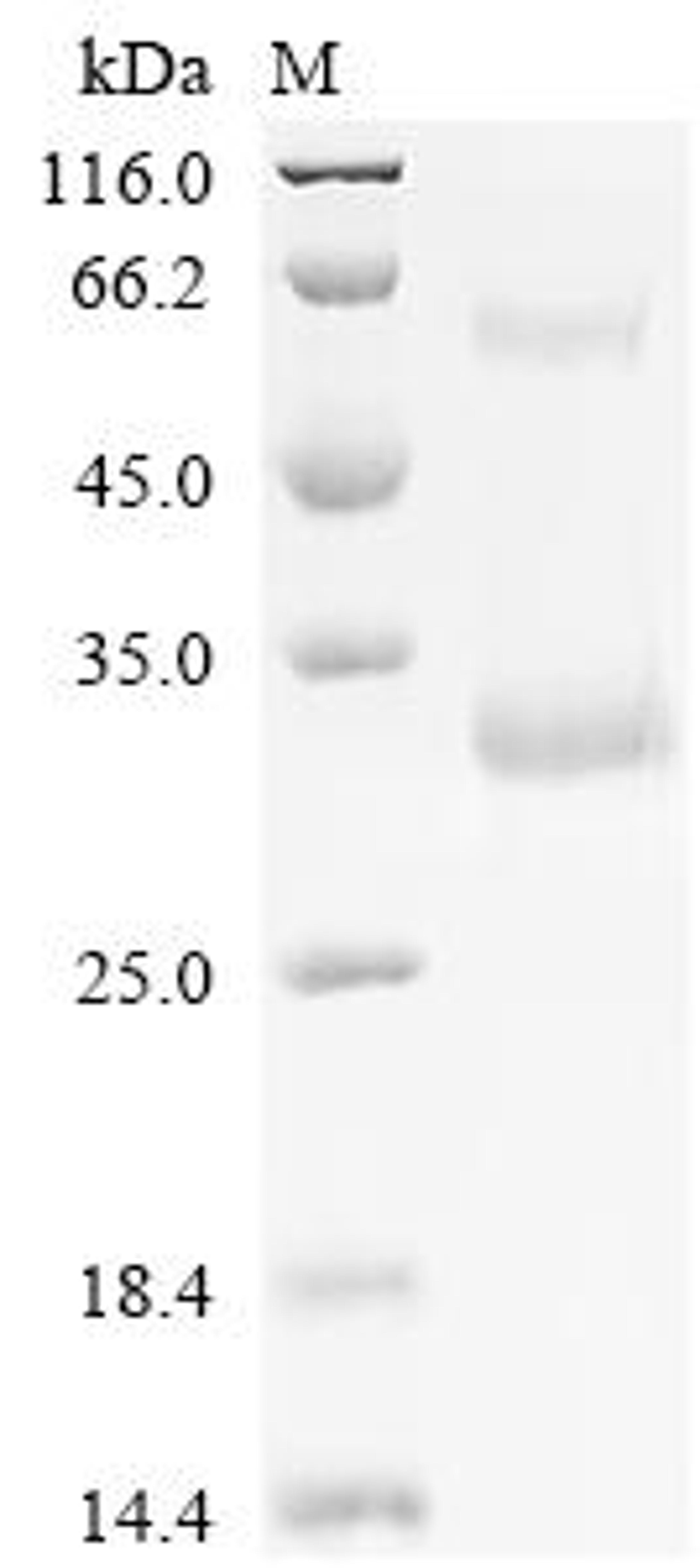 (Tris-Glycine gel) Discontinuous SDS-PAGE (reduced) with 5% enrichment gel and 15% separation gel.