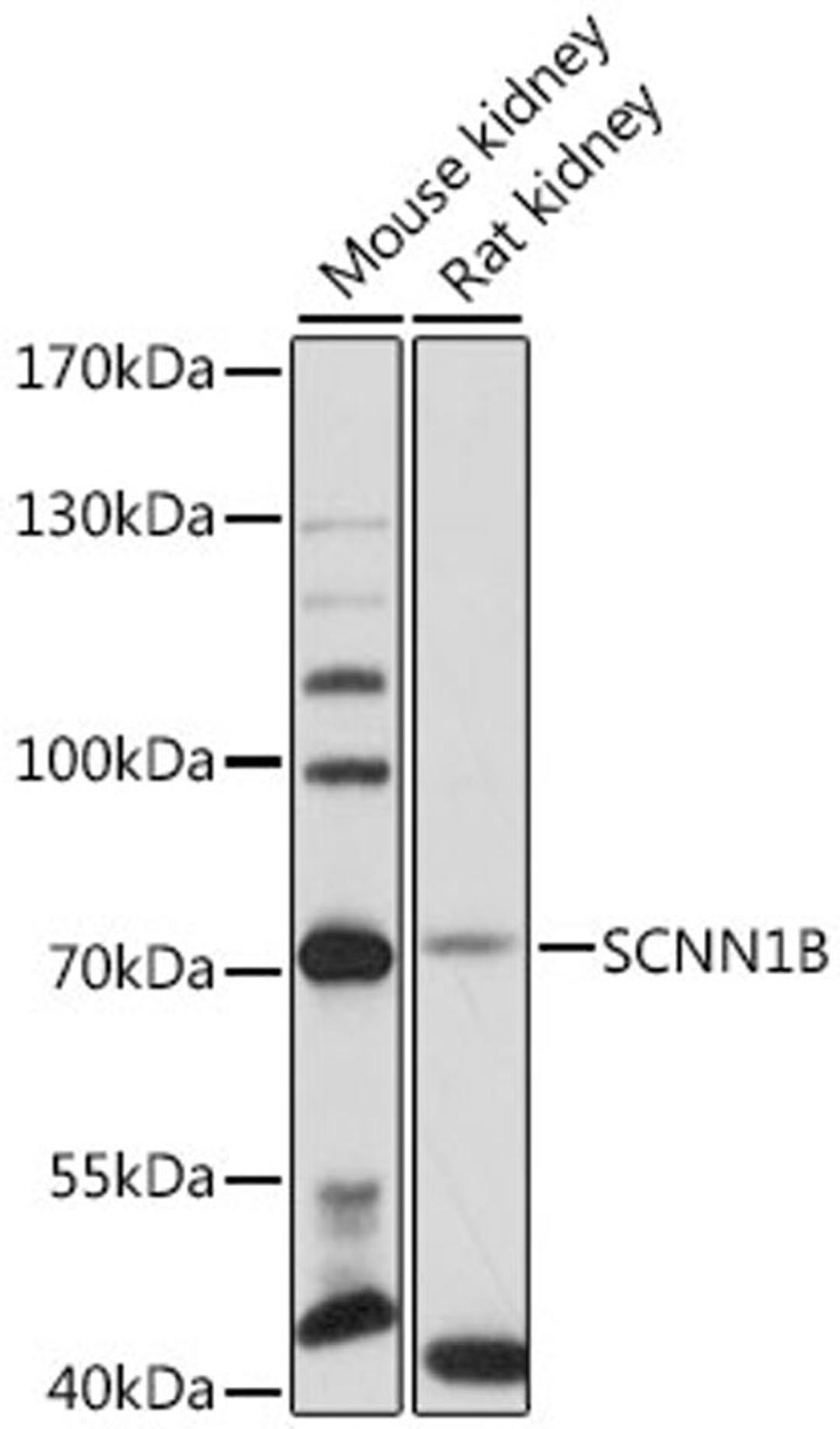 Western blot - SCNN1B antibody (A12699)