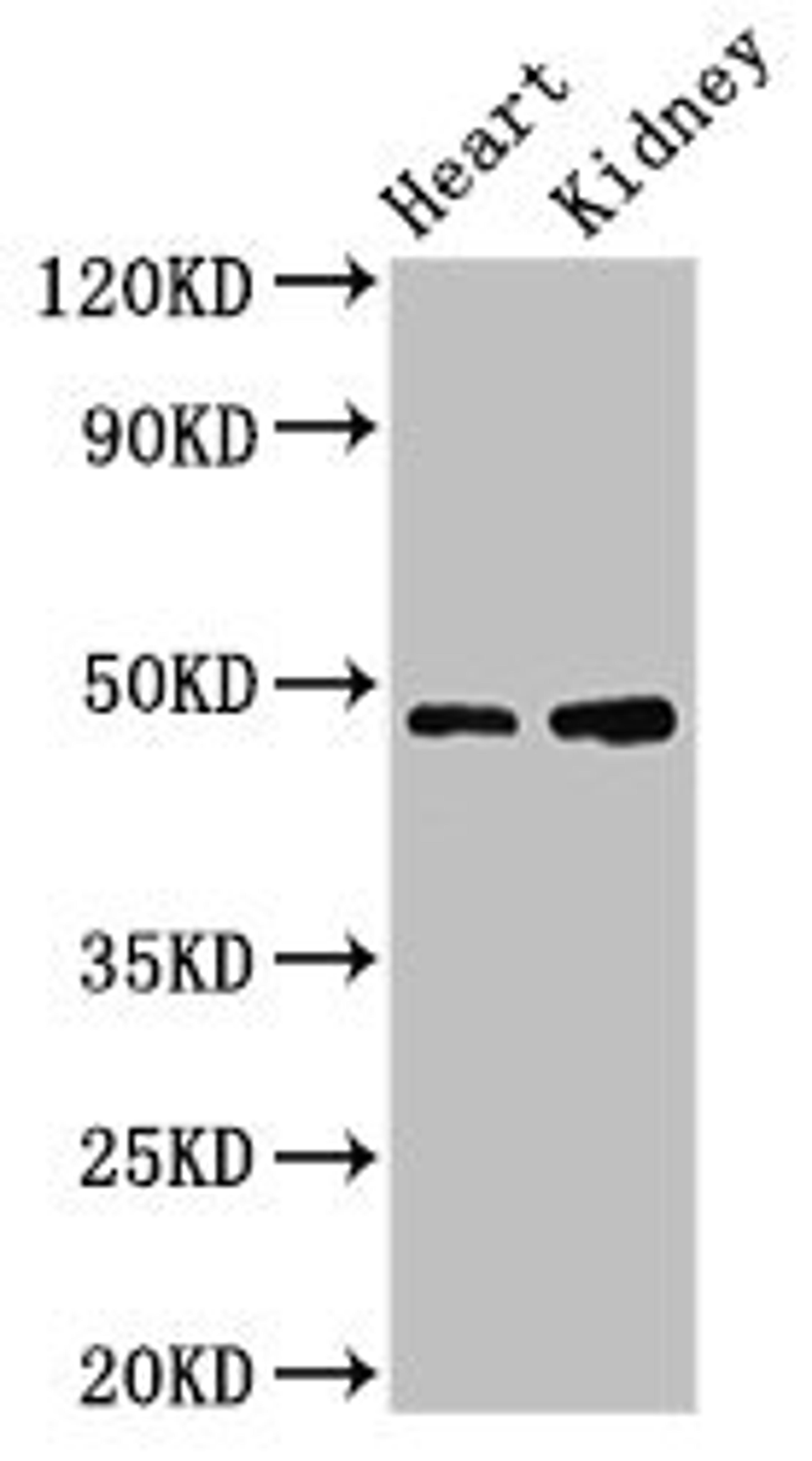 Western Blot. Positive WB detected in: Mouse heart tissue, Mouse kidney tissue. All lanes: CCNE1 antibody at 3.2ug/ml. Secondary. Goat polyclonal to rabbit IgG at 1/50000 dilution. Predicted band size: 48, 42, 46 kDa. Observed band size: 48 kDa.