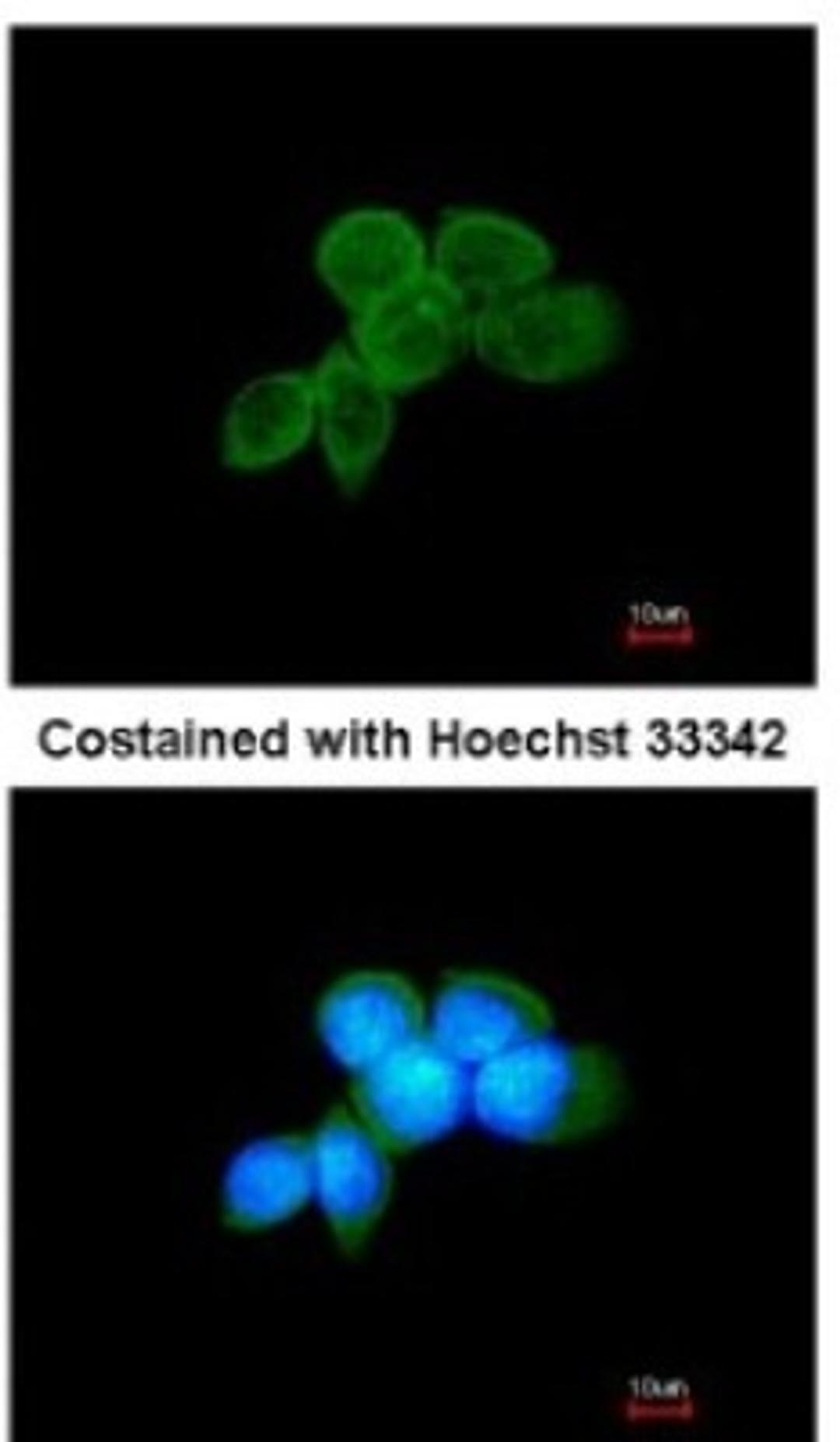 Immunocytochemistry/Immunofluorescence: SYK Antibody [NBP1-32945] - Analysis of methanol-fixed A431, using antibody at 1:200 dilution.