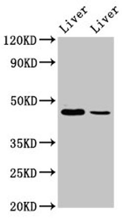 Western Blot. Positive WB detected in: Mouse liver tissue, Rat liver tissue. All lanes: DDB2 antibody at 4.9ug/ml. Secondary. Goat polyclonal to rabbit IgG at 1/50000 dilution. Predicted band size: 48, 27, 18, 41 kDa. Observed band size: 48 kDa. 