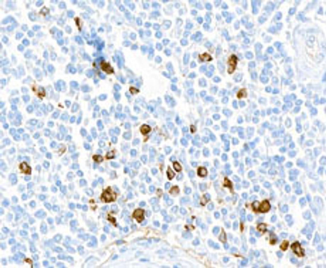 Detection of human hIgG4 in FFPE tonsil by immunohistochemistry.