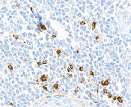 Detection of human hIgG4 in FFPE tonsil by immunohistochemistry.