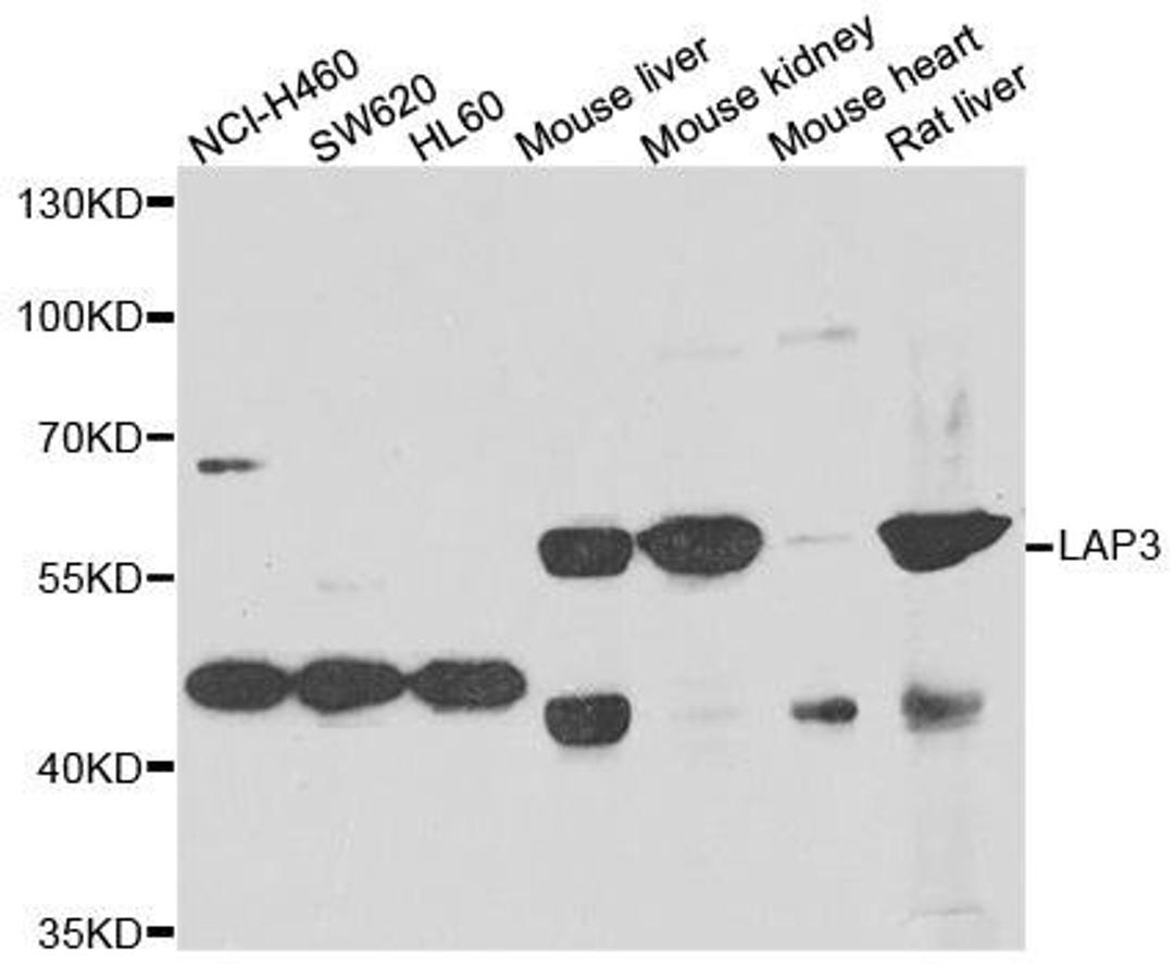 Western blot analysis of extracts of various cell lines using LAP3 antibody