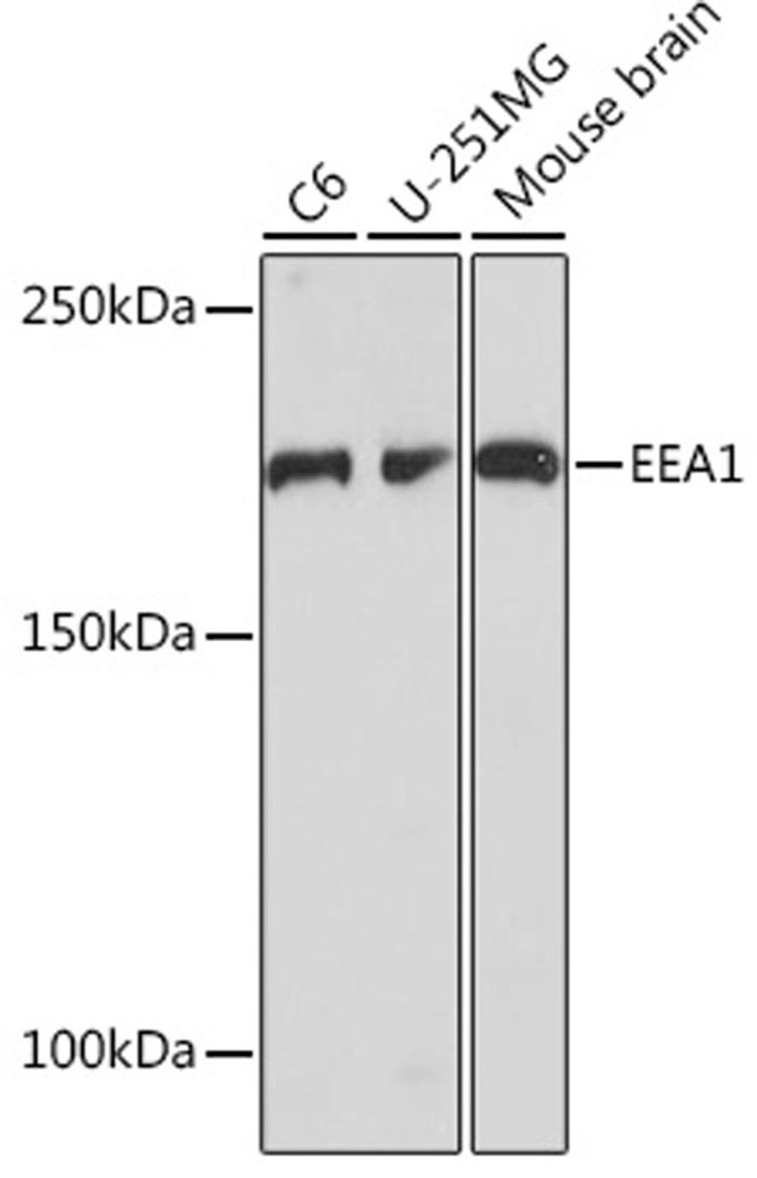 Western blot - EEA1 Rabbit mAb (A5057)